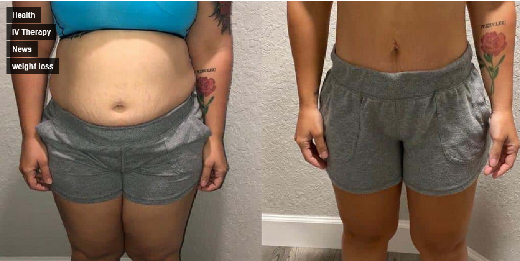 Glutathione Injections Help With Weight Loss at Brandon Medical Ctr
