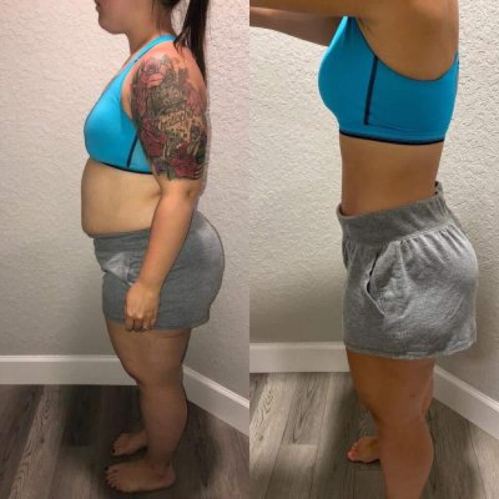 Start Losing Weight Today, Get Healthy with successful weight loss