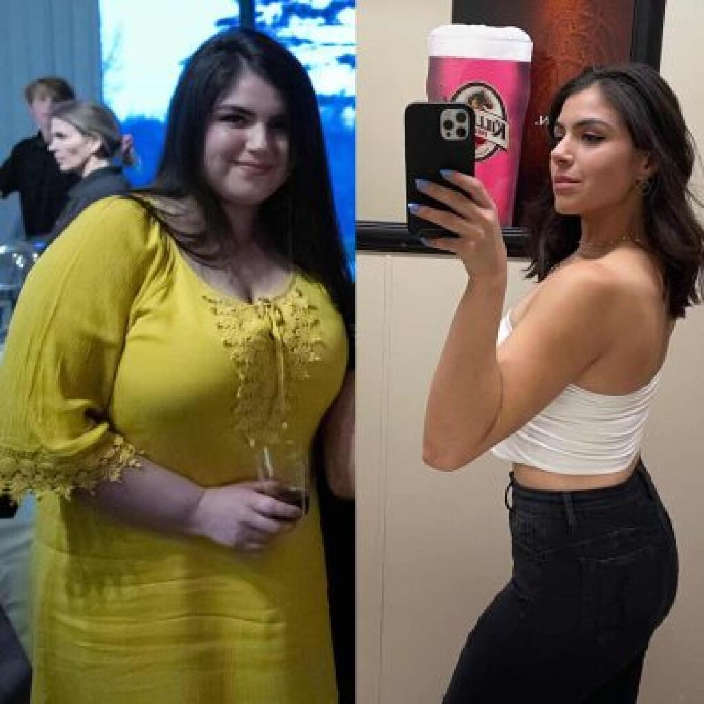 Start Losing Weight Today, Get Healthy with successful weight loss