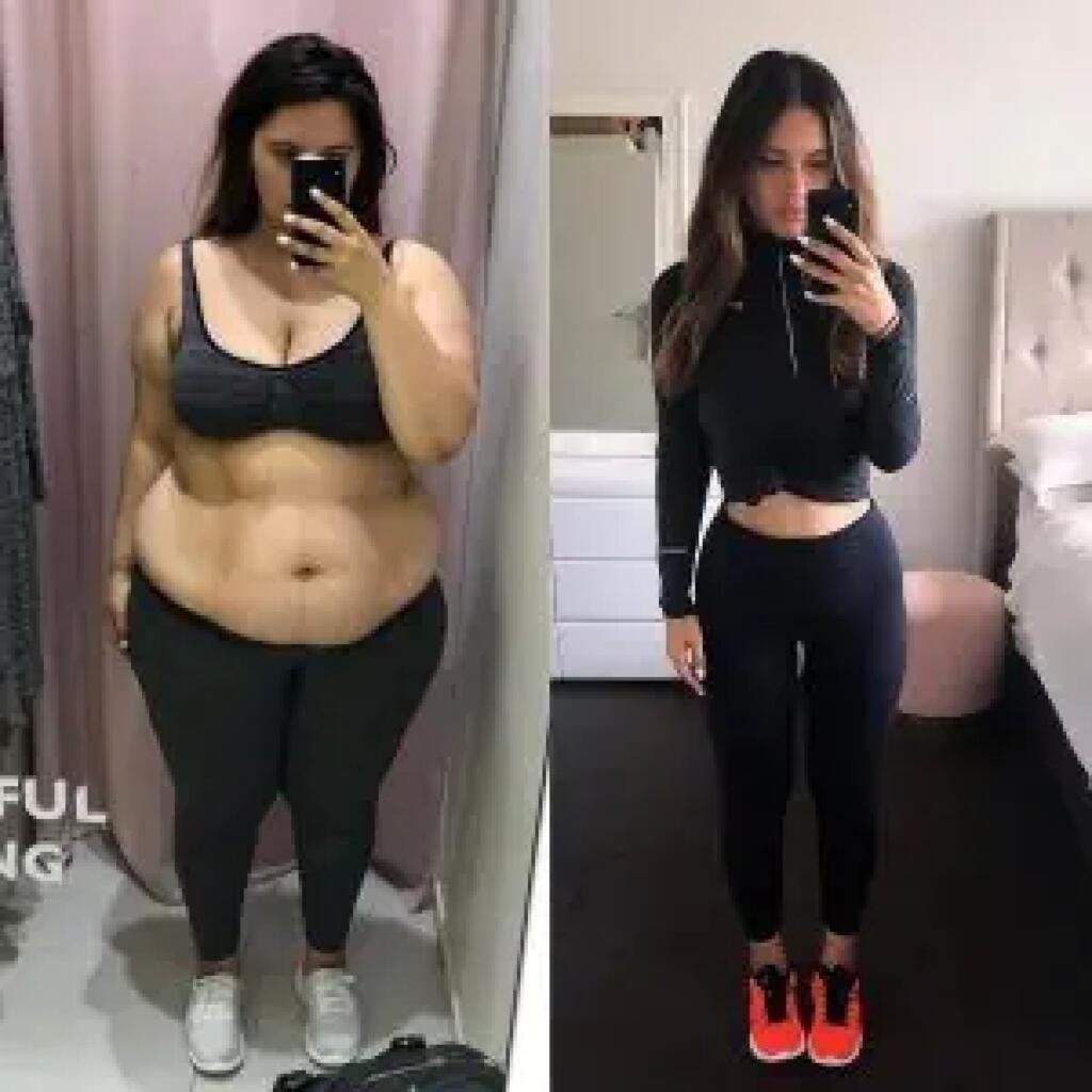weight loss using Semaglutide Ozemptic Weight Loss Consultation